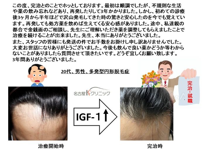 円形脱毛症　病院